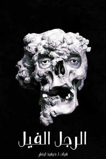 The Elephant Man